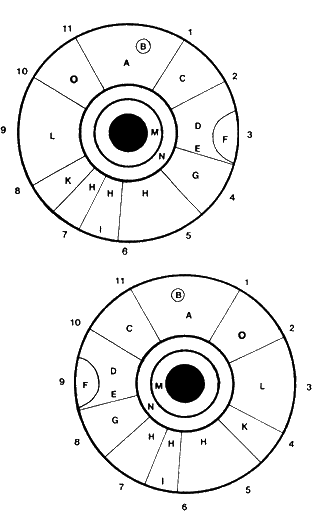 Схема проекционных зон тела человека на радужной оболочке