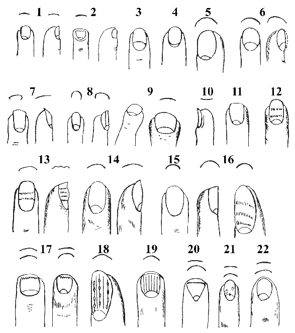 Ногтевая диагностика